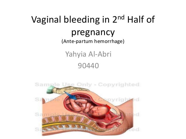 Piss in the bible Bleeding from the vagina during pregnancy